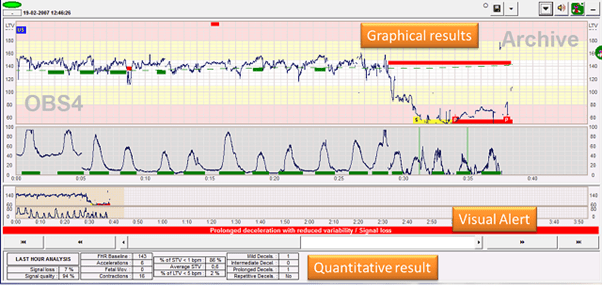 Omniview Sisporto