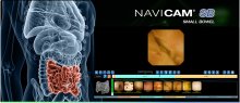 NAVICAM® SB WITH ESVIEW